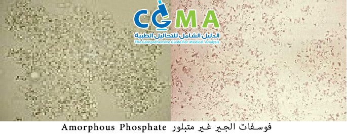 تحليل البول كاملا بالصور Urine Analysis علومنجى دوت كوم