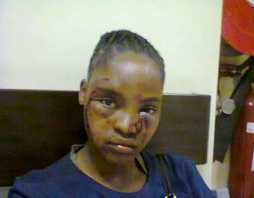 lady beaten boyfriend durban