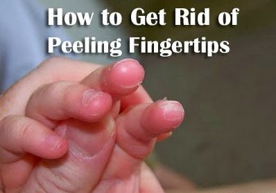 Causes Of Peeling Fingertips: