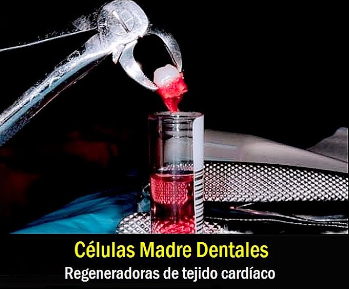 CÉLULAS MADRE DENTALES, regeneradoras de tejido cardíaco