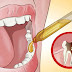 Here’s How to Cure Your Toothache in LITERALLY Seconds