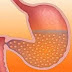 Wax Badan Ka Baro Cudurka Soomaalida Ku Badan Gaastiriko (Gastritis). thumbnail