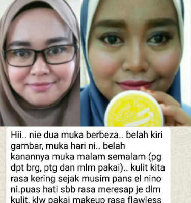 honey bee venom testimoni