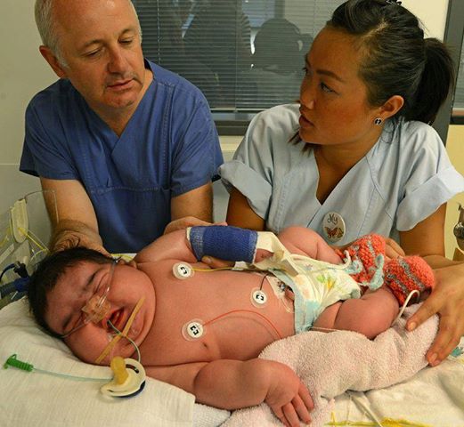 Baby Jasleen Born At 13 47 Pounds Is Germany s Heaviest Baby Born baby-jasleen-born-at-13-47-pounds-is-germany-s-heaviest-baby-born