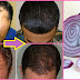 How To Regrow Hair Faster, Long And Thick Using Onion Juice