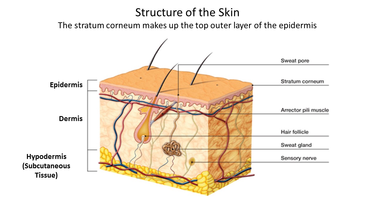 Ektalks Why Does Steam Cause More Severe Burns Than Hot Water Physics Of Thermal Burns