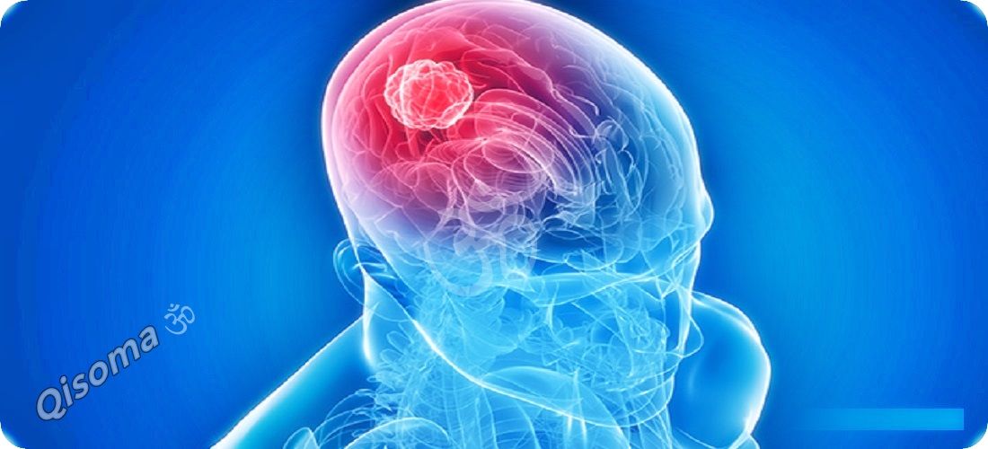La deficiencia de colesterol en el cerebro causa pérdida de memoria cerebro