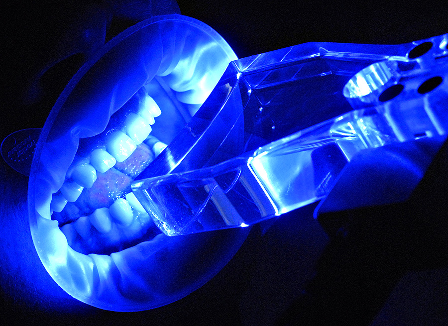 Уф отбеливание зубов. Ультрафиолетовое излучение люминесценция. Ультрафиолетовая лампа для зубов. Ультрафиолетовая лампа для отбеливания зубов. Ультрафиолетовое свечение.
