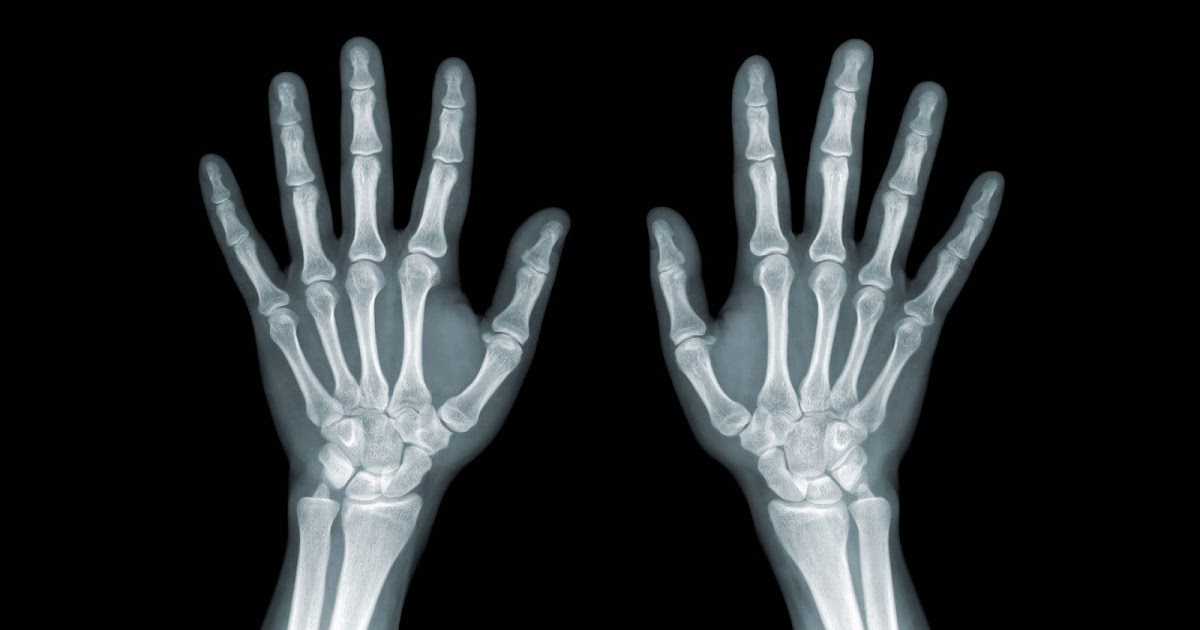 Wrist/Hand Arthritis And Trauma Diagnostic Imaging El Paso, TX.