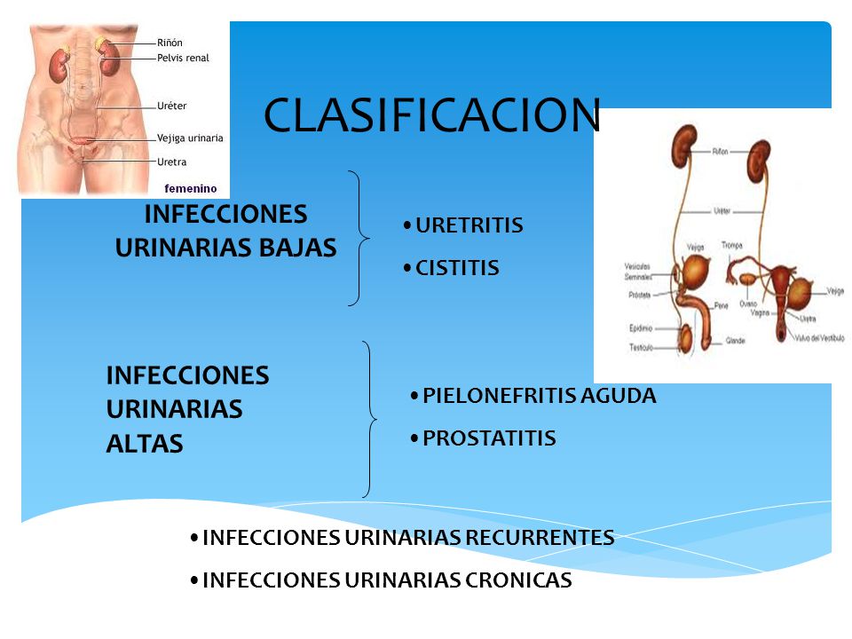 Clasificación de las infecciones urinarias