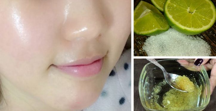 Here's How To Use Lemon To Have Amazing Skin