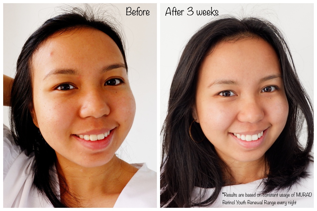 murad retinol night cream reviews