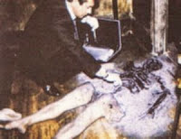 Human Combustion