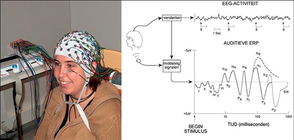 Neurosains Kognitif: Pengertian, Studi-studi, dan Teknik atau Metode Neurosains Kognitif: Pengertian, Studi-studi, dan Teknik atau Metode