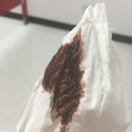 What Is Implantation Bleeding? (5 Ways to Distinguish Period From - what does implantation bleeding look like on a pad