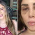 Youtuber choca com relato sobre implante no bumbum: "Ou eu tirava, ou morreria"