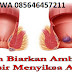 Obat BAB Berdarah, Nyeri dan Pembengkakan di Anus thumbnail