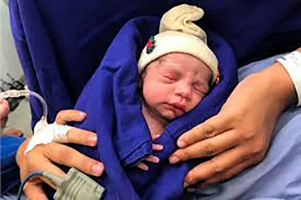 World's First Baby Born Out Of Womb Transplanted From Dead Donor