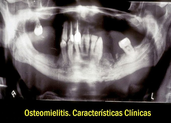 OSTEOMIELITIS: Características Clínicas