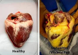 10 FOODS THAT WILL CLEAN YOUR ARTERIES NATURALLY AND PROTECT YOU FROM HEART ATTACKS