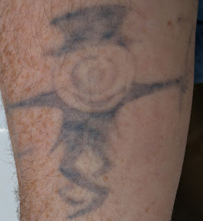 Tattoo fading Tattoo fading after two years of Picosure