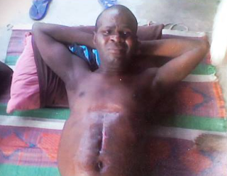 Photos: Man brutally tortured for weeks, thrown down from 3 storey building in PH on alleged order of Navy Commodore, cries for justice