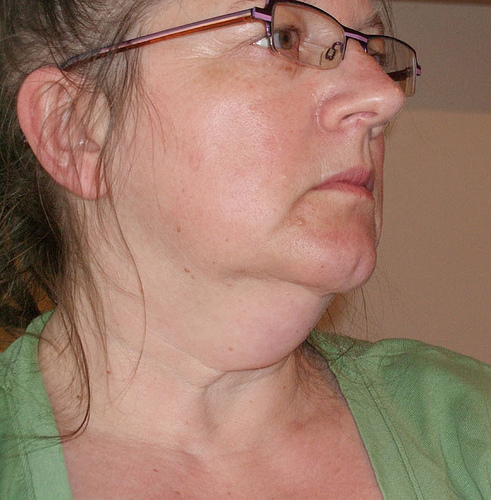 Performing Your Own Natural Facelift Using Facial Aerobics Exercises performing-your-own-natural-facelift-using-facial-aerobics-exercises