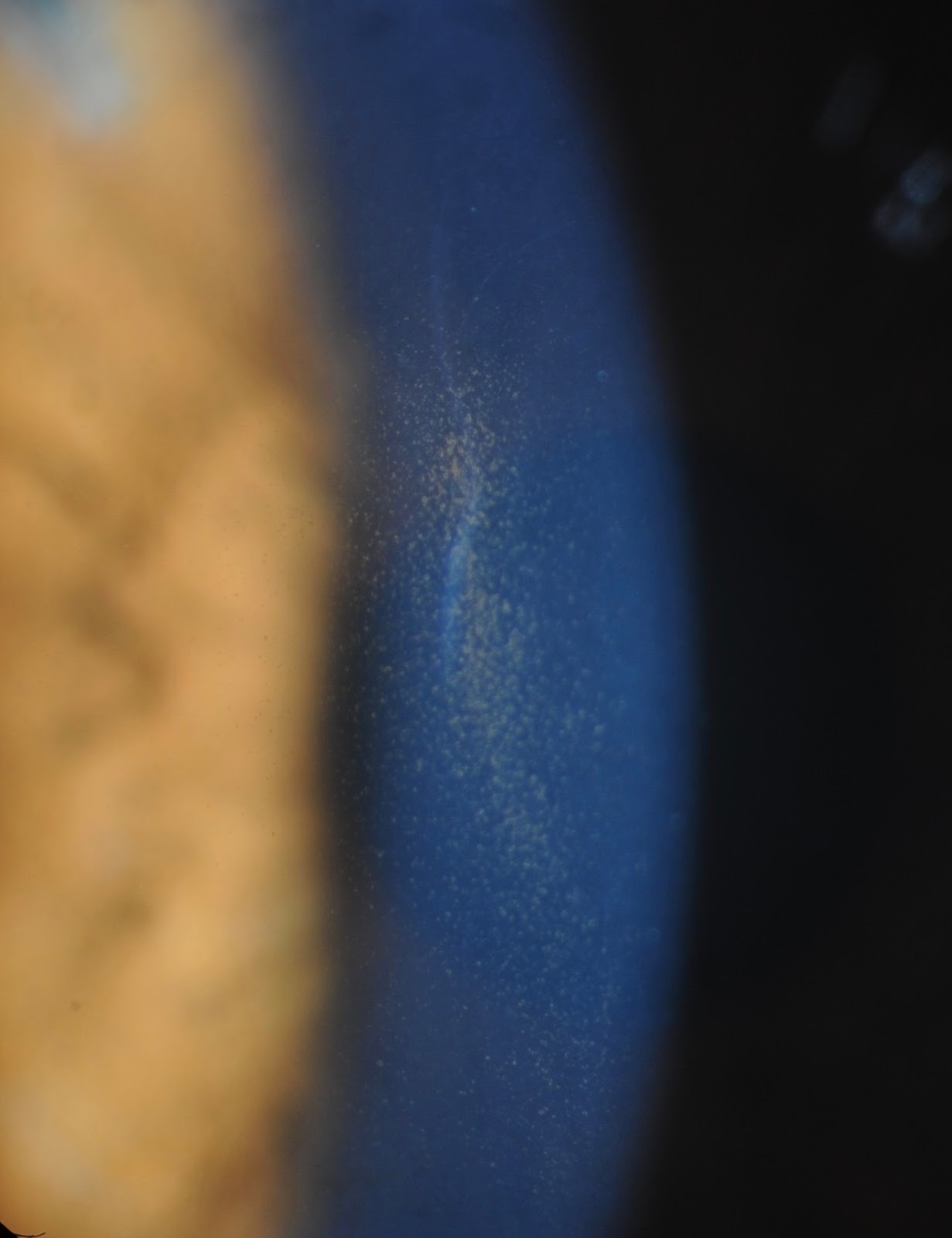 SPECIALIST BLOG "THE GLOG" PIGMENTARY