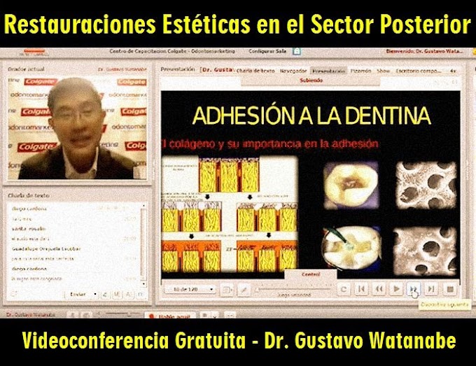 VIDEOCONFERENCIA: Restauraciones Estéticas en el Sector Posterior - Dr. Gustavo Watanabe