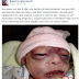 Lady Narrates How Her Baby Was Born Badly Deformed Due to Self-Medication