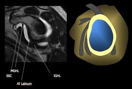 MRI Musculo-Skeletal Section: Glenohumeral ligaments
