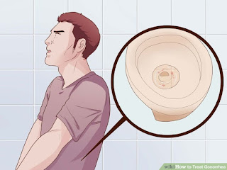 Obat Ampuh Kencing Keluar Cairan Kental Obat Ampuh Kencing Keluar Cairan Kental