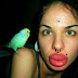 15 photos de chirurgies d'augmentation de lèvres complètement démesurées, folles et inimaginables!