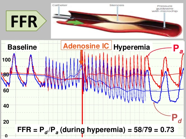 Dr.Nabil Paktin's Journal of Cardiovascular Medicine Blog ژورنال ( قلب ...