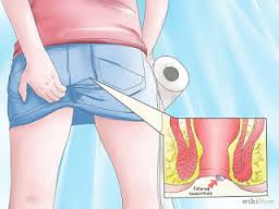 Obat Tradisional Penyakit Sipilis Obat Tradisional Penyakit Sipilis