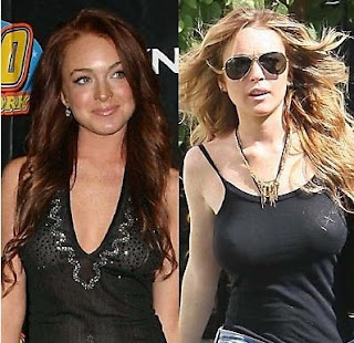 Lindsay Lohan Boob Job