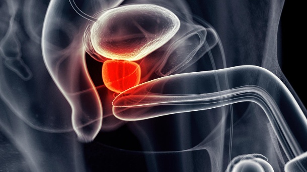POTENCIJA I HRONIČNA UPALA PROSTATE « Preventiva i zdravlje