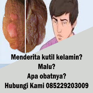 Obat Kutil Kelamin Di Apotik K24 Anus 1 Hari Rontok Obat Kutil Kelamin Di Apotik K24 Anus 1 Hari Rontok