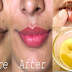 10 Tricks To Lighten Dark Lips, Lip Line And To Get Beautiful, Smooth Soft Pink Lips