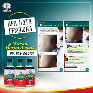 Testimoni Minyak Herba Asmak