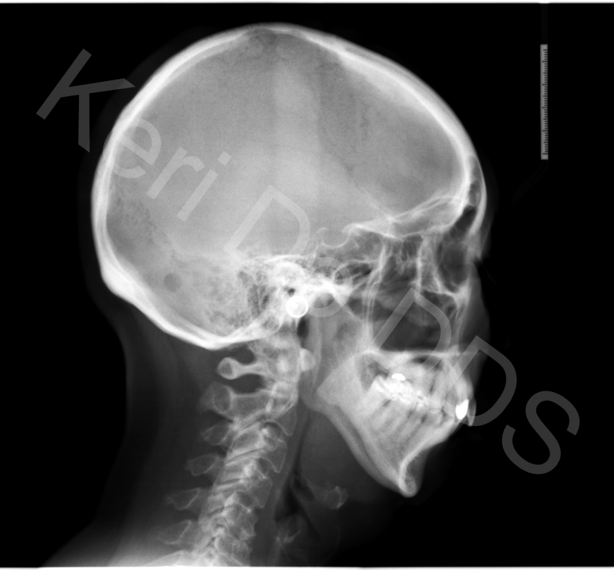 Manoa Dental Orthodontics and airway