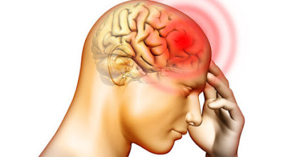 Beberapa Jenis Sakit Kepala Yang Tidak Boleh Di Remehkan