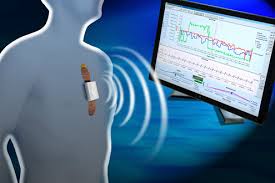 IOT Based ICU Patient Monitoring System