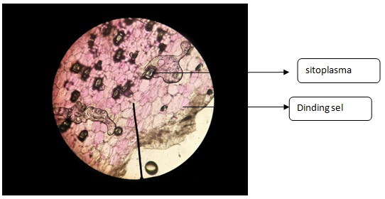 All About Teenager Laporan Praktikum Biologi Difusi