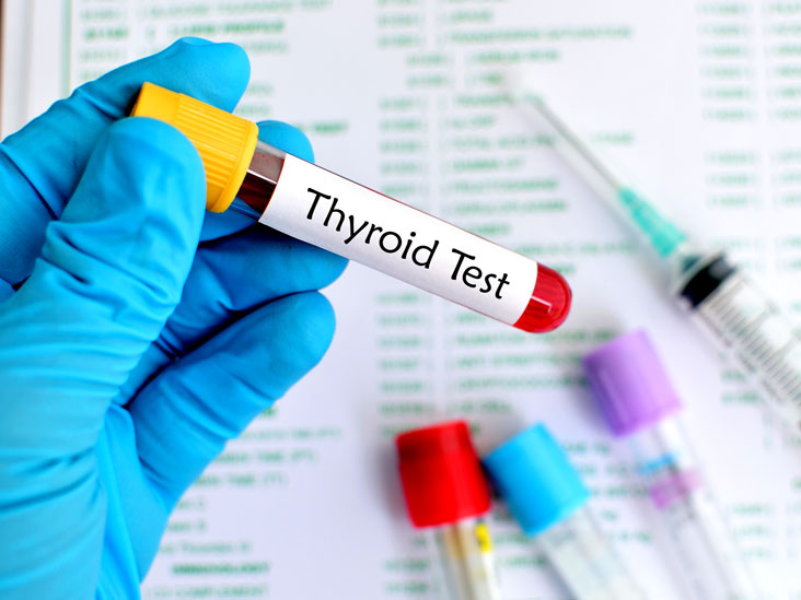 Learn all About a Thyroid Test and Its Types