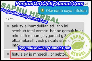 Cara Cepat Menyembuhkan Fistula Ani Tanpa Operasi Cara Cepat Menyembuhkan Fistula Ani Tanpa Operasi