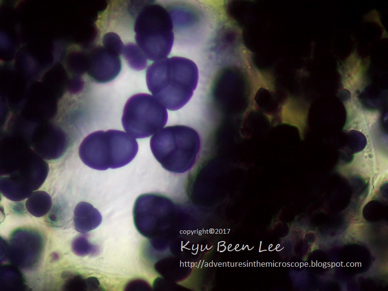 MicroWorld sweet potato full of starches