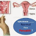 Paket Obat Keputihan Dan Perapat Paling SUPER thumbnail