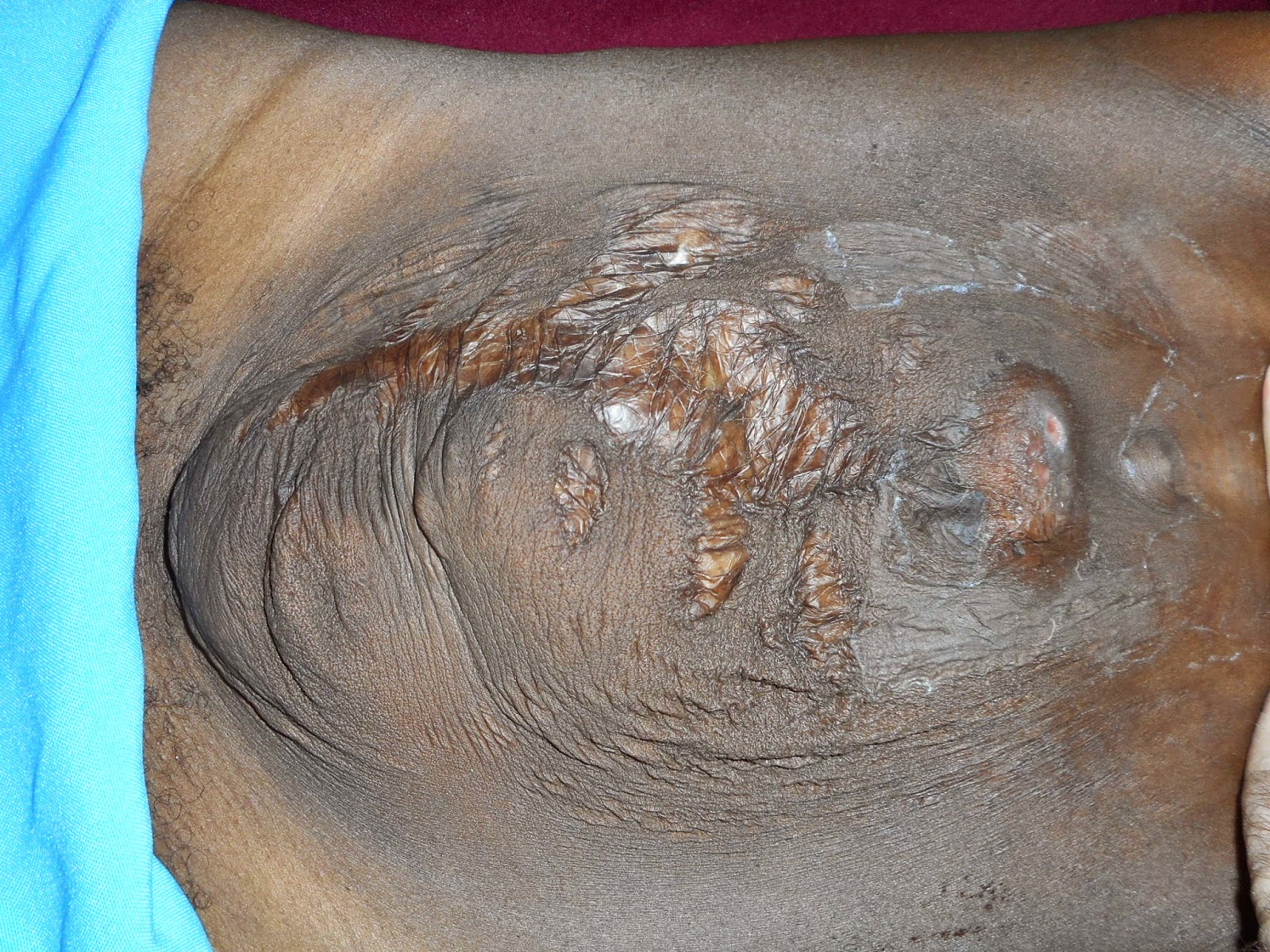 Kibogora 2014: November 2014