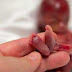 Sebelum ke Surga, Bayi 19 Minggu Ini Sempat Jumpa Sang Ibu selama 1 Menit
